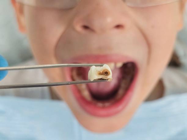 Best Walk-In Emergency Dentist in Flowery Branch, GA
